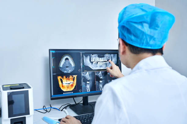 Best Knocked-Out Tooth (Avulsed Tooth) Treatment in Shaw, MS